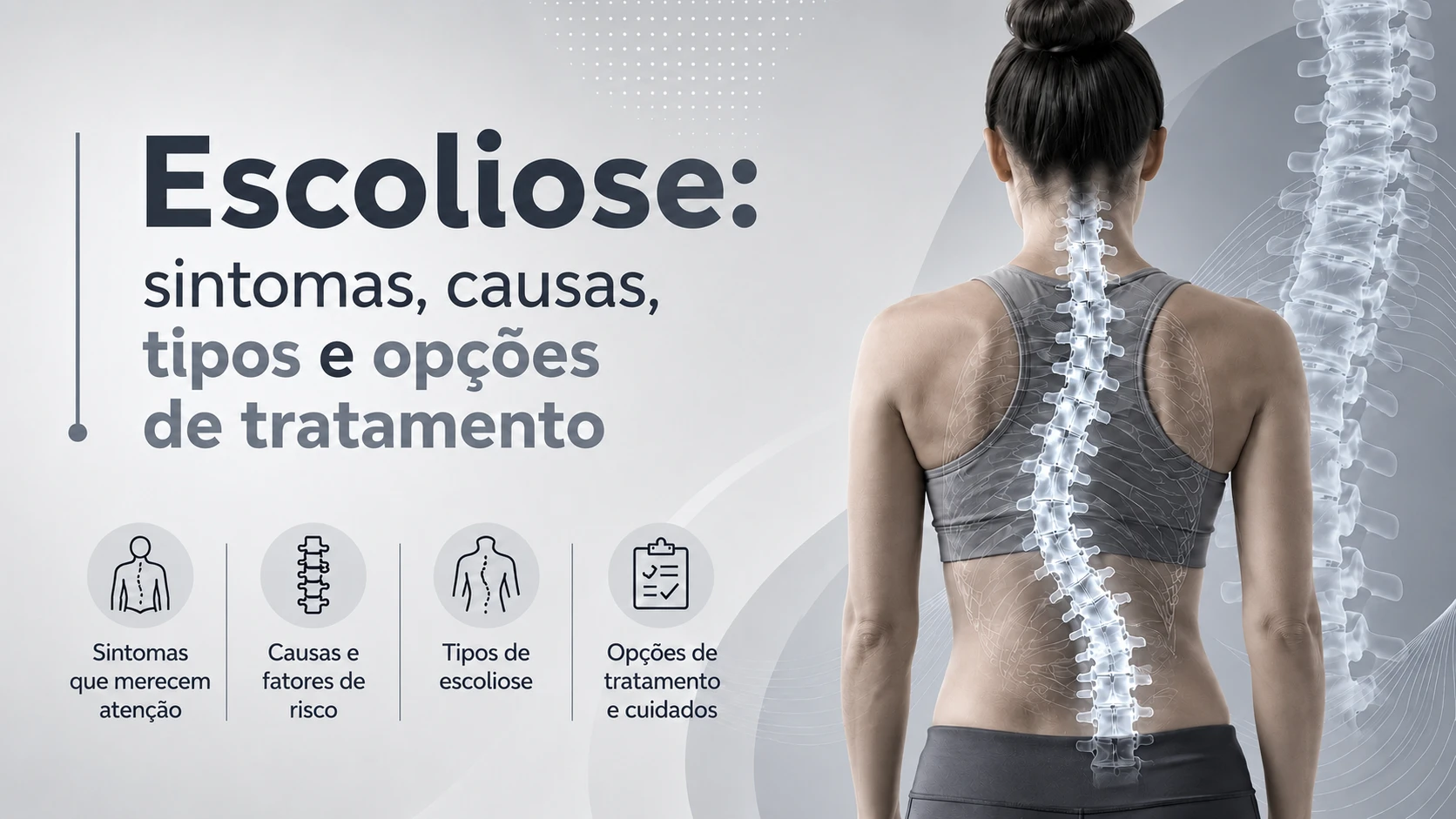 Ilustração sobre escoliose e desvio da coluna Ilustração sobre escoliose e desvio da coluna